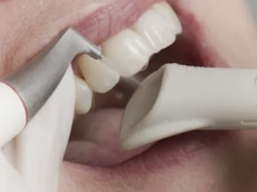 Чистка зубов AirFlow