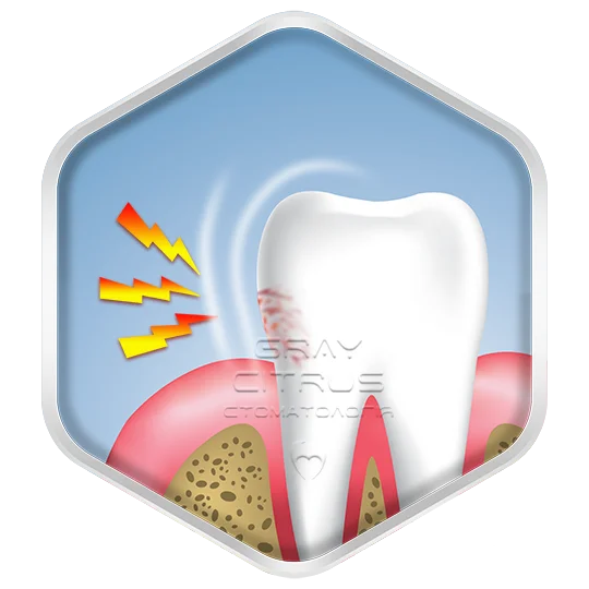 Герметизация эмали - снижение чевствительности зубов