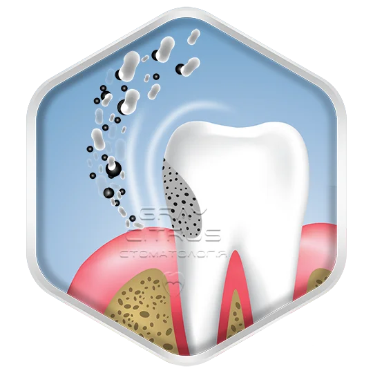 Защита зубов от кариеса и ослабления эмали