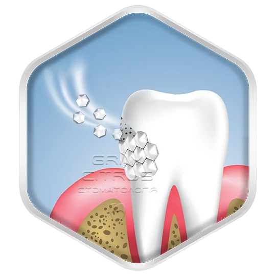 Фторирование зубов и восстановление структуры эмали зубов